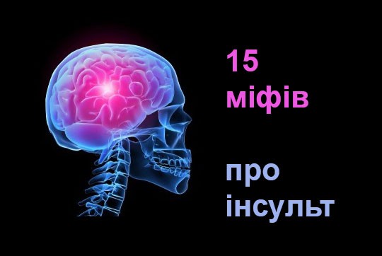 Міф та правда при інсульті